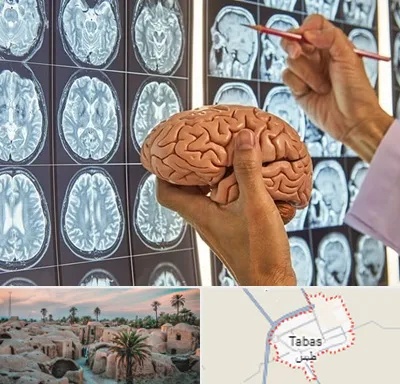جراح مغز و اعصاب در طبس