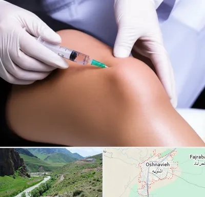 پلاسما درمانی PRP در اشنویه