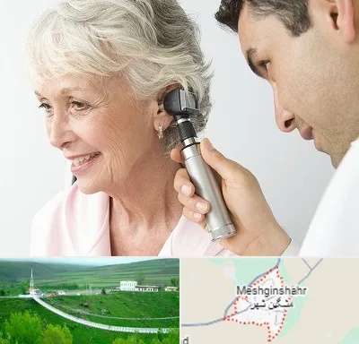 شنوایی سنجی در مشگین شهر