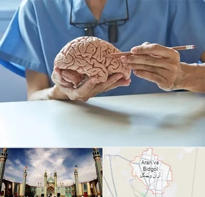 دکتر نورولوژی در آران و بیدگل