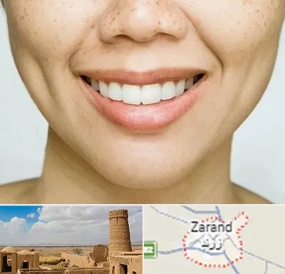 عمل چال گونه در زرند