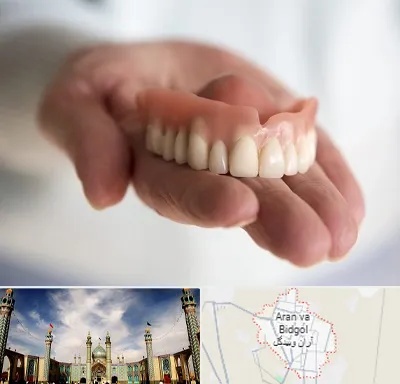 لیفت لثه با لیزر در آران و بیدگل