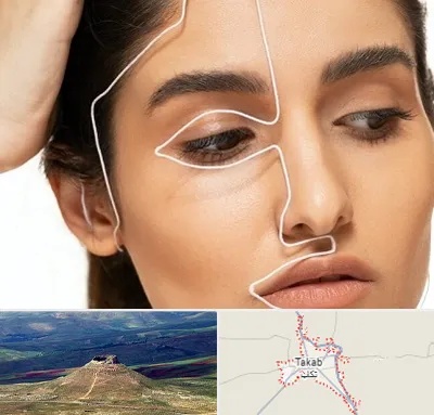 عمل بینی اقساطی در تکاب