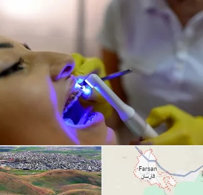 دندانپزشکی با لیزر در فارسان