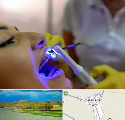 دندانپزشکی با لیزر در بستان آباد