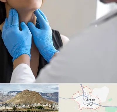 دکتر سرطان گلو در گراش