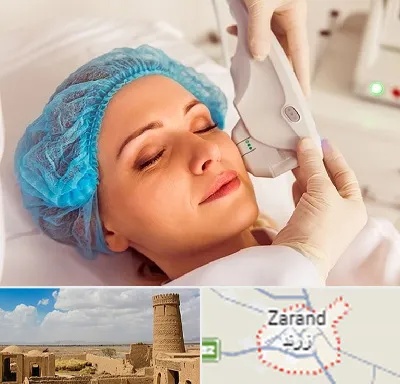 اکسنت در زرند