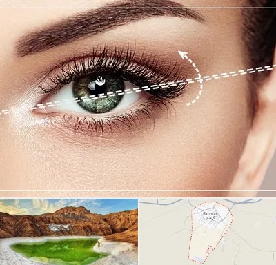 جراحی چشم گربه ای در گرمسار