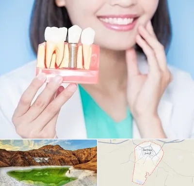 متخصص ایمپلنت در گرمسار