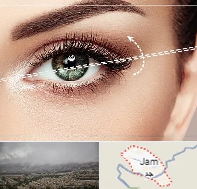 جراحی چشم گربه ای در جم