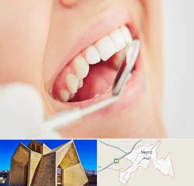 اصلاح طرح لبخند در نی ریز
