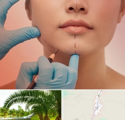 دکتر زیبایی خانم در کهنوج