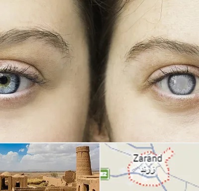 متخصص آب سیاه (گلوکوم) در زرند