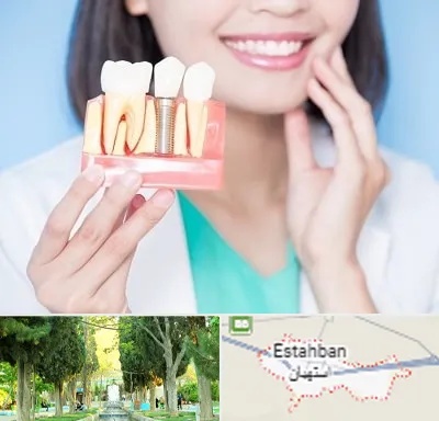 متخصص ایمپلنت در استهبان