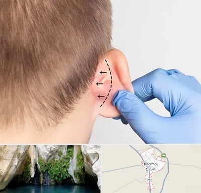 عمل زیبایی گوش در خورموج