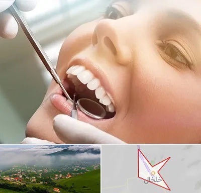 دندانپزشکی زیبایی در خلخال