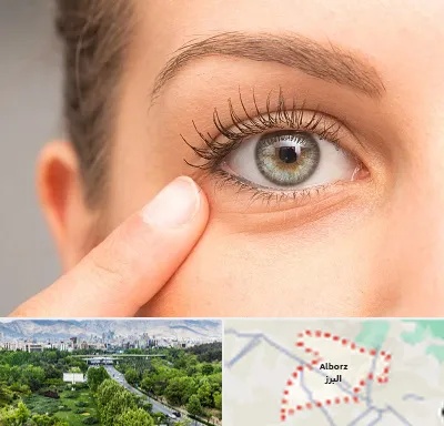جراح پف چشم در البرز