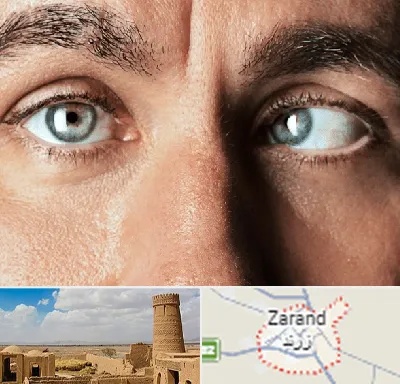 فوق تخصص استرابیسم در زرند