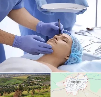 عمل بینی طبیعی در نقده