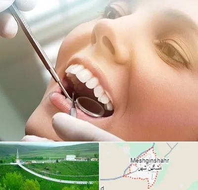 دندانپزشکی زیبایی در مشگین شهر