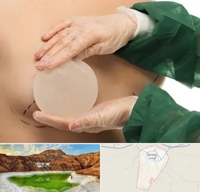 جراحی پروتز سینه در گرمسار