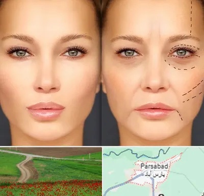 متخصص زیبایی چشم در پارس آباد