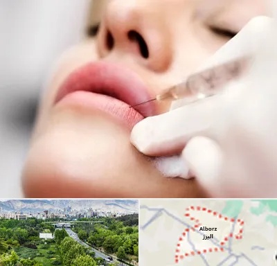 کلینیک تزریق ژل لب در البرز