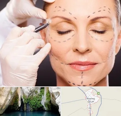 دکتر زیبایی صورت در خورموج