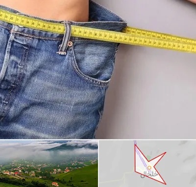 عمل لیپوماتیک در خلخال