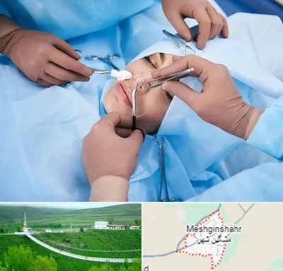 عمل بینی فانتزی در مشگین شهر