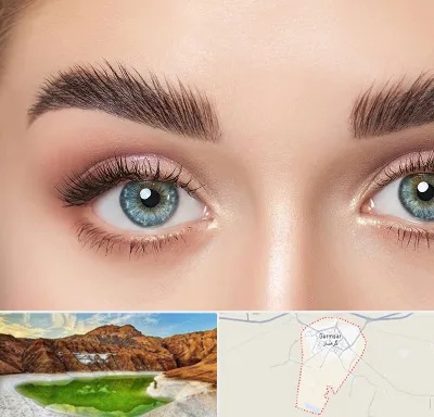 لیفت ابرو در گرمسار