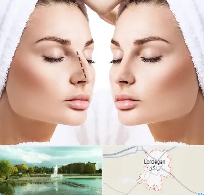 عمل بینی در لردگان