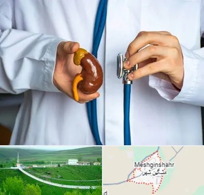 دکتر سرطان کلیه در مشگین شهر