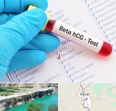 آزمایشگاه بارداری در کوار