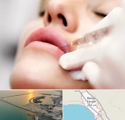 کلینیک تزریق ژل لب در بندر کنگان