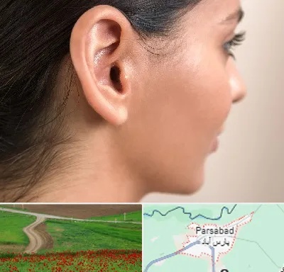 عمل گوش بل در پارس آباد