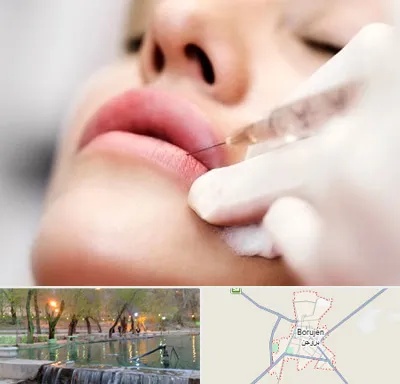 کلینیک تزریق ژل لب در بروجن