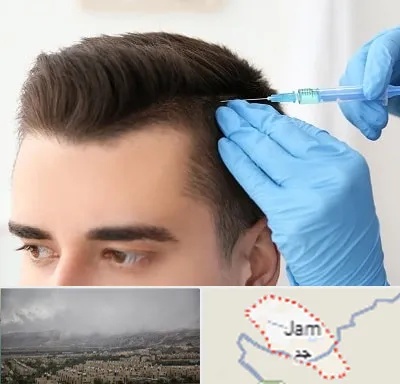 مزوتراپی مو در جم