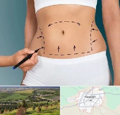 دکتر طب سنتی برای لاغری در نقده