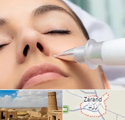 پلاسما جت بینی در زرند