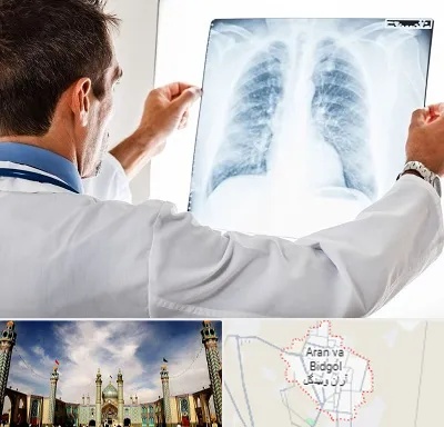 دکتر متخصص ریه در آران و بیدگل