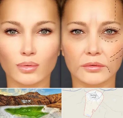متخصص زیبایی چشم در گرمسار