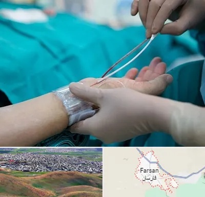 آنژیوگرافی در فارسان