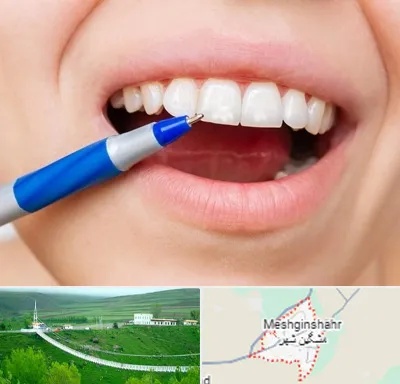 دندانسازی ارزان در مشگین شهر
