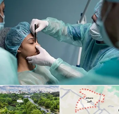 عمل بینی ارزان در البرز