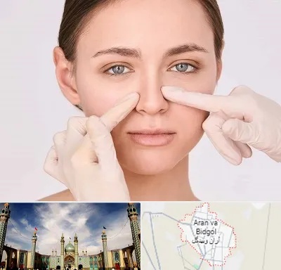 جراح راینوپلاستی در آران و بیدگل