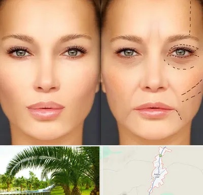 متخصص زیبایی چشم در کهنوج