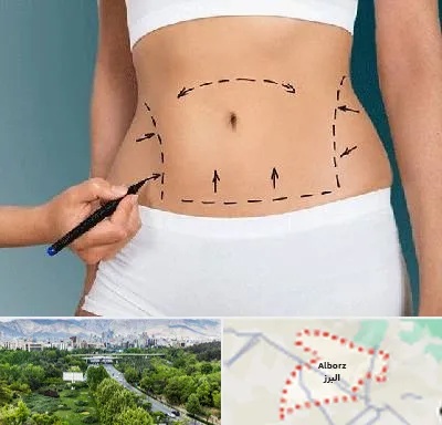 دکتر طب سنتی برای لاغری در البرز