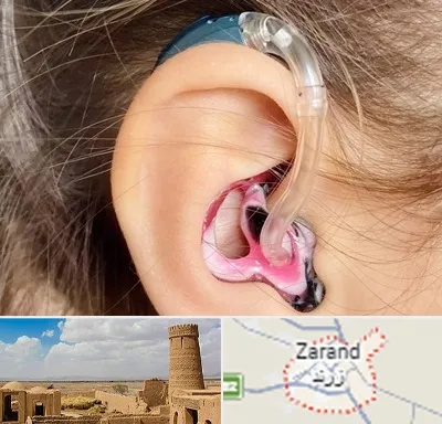 ساخت قالب سمعک در زرند