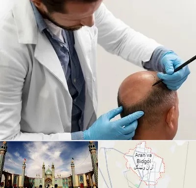 کاشت مو به روش تکثیری در آران و بیدگل